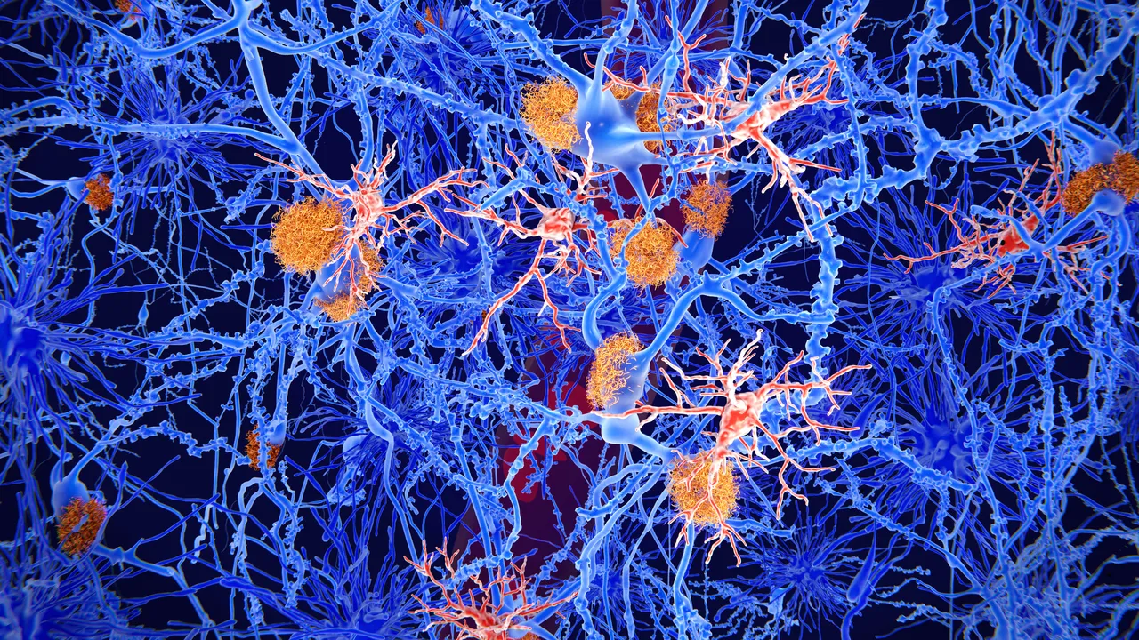 Una molécula podría reactivar las defensas naturales del cerebro contra el Alzheimer