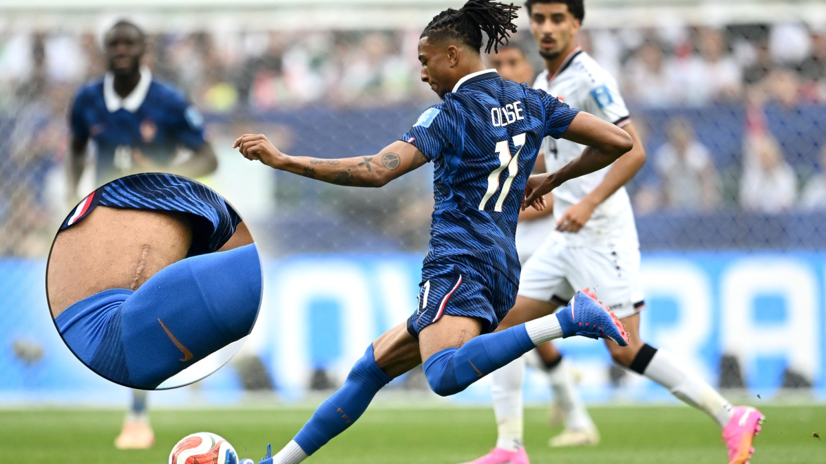 La cicatriz de Olise que llama la atención en el Mundial
