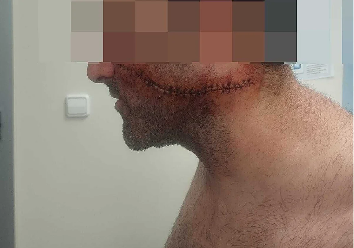 La hermana del trabajador al que rajaron la cara en Málaga: «Lo han dejado marcado para toda la vida»