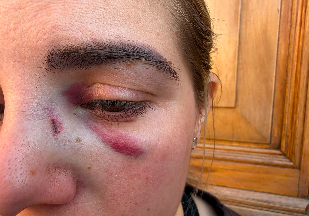 Un paciente rompe de un puñetazo la nariz a una doctora en Villanueva del Rosario