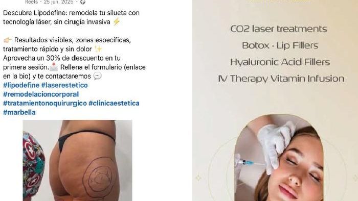 Sanidad cierra la clínica de Marbella del médico de la 'lipo' mortal a Sara: ofertaba servicios de cirujano plástico