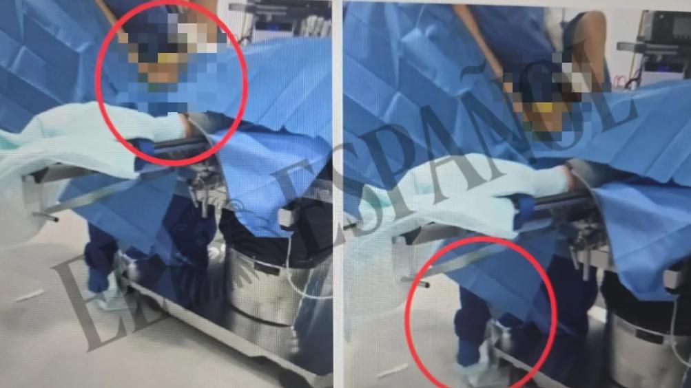 La Policía detecta en una faja 'mezcla' de ADN del cirujano plástico acusado de violar a su paciente: 'No hay esperma'