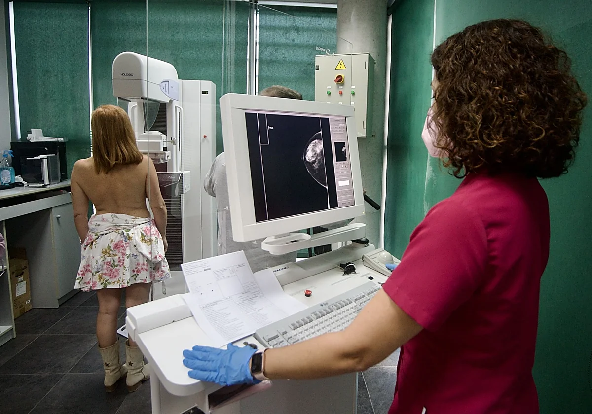Una calculadora predecirá el riesgo de sufrir cáncer de mama en cinco años