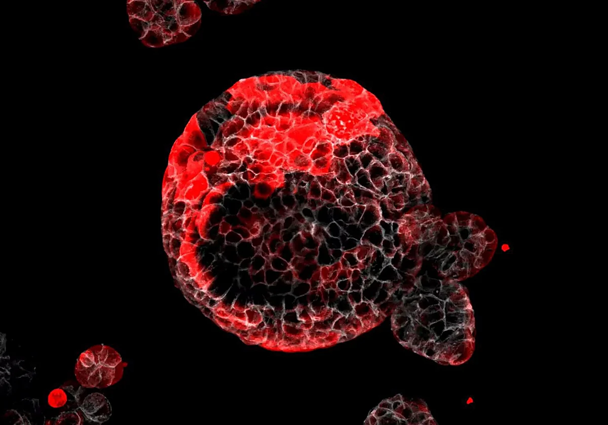 El secreto para vivir 110 años: multiplicar unas células raras que acaban con el cáncer