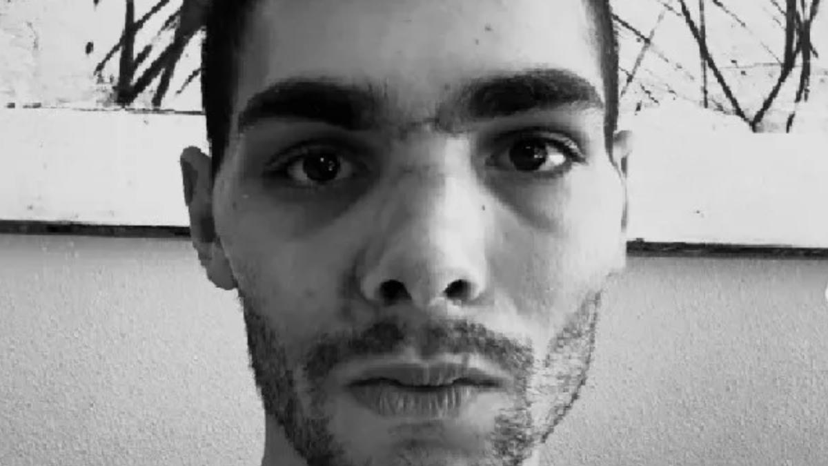 Las fotos del horror de Baroncini, el socio de Pogacar que sobrevivió al coma: “Tenía la mandíbula rota, la nariz aplastada y casi quedo ciego”