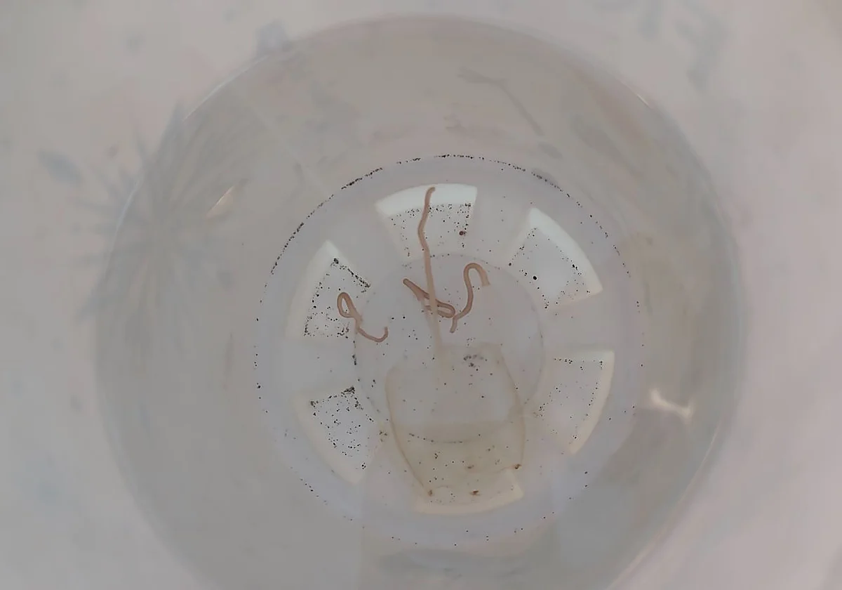 El peligro que no se ve: detectan la presencia de medusas cubo en varias playas de Málaga