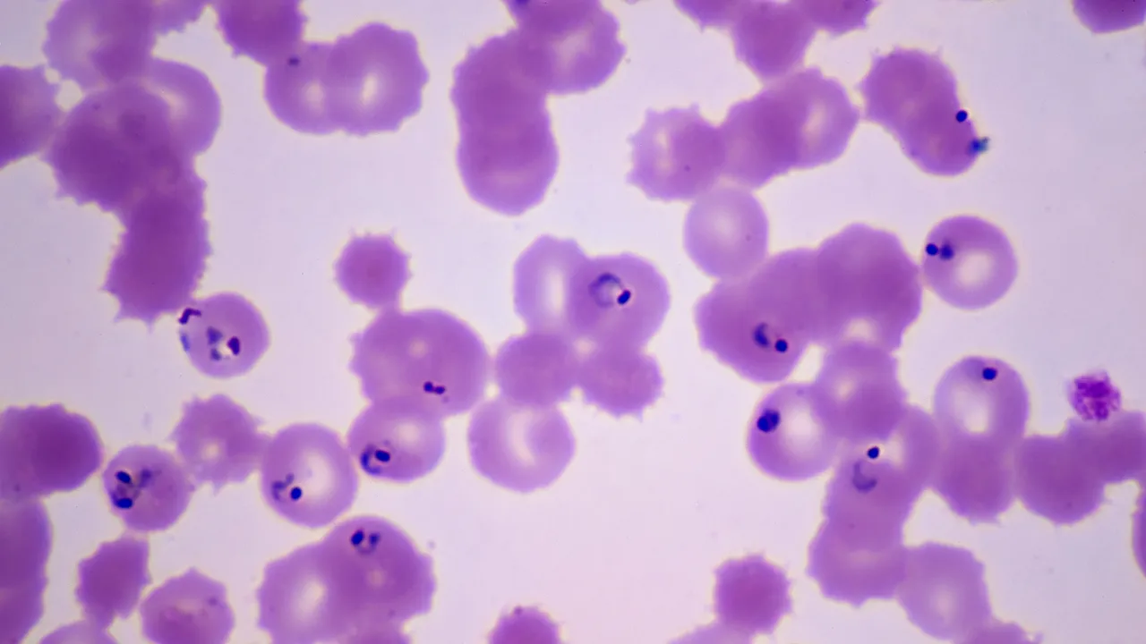 Una mutación amenaza el tratamiento más usado contra la malaria