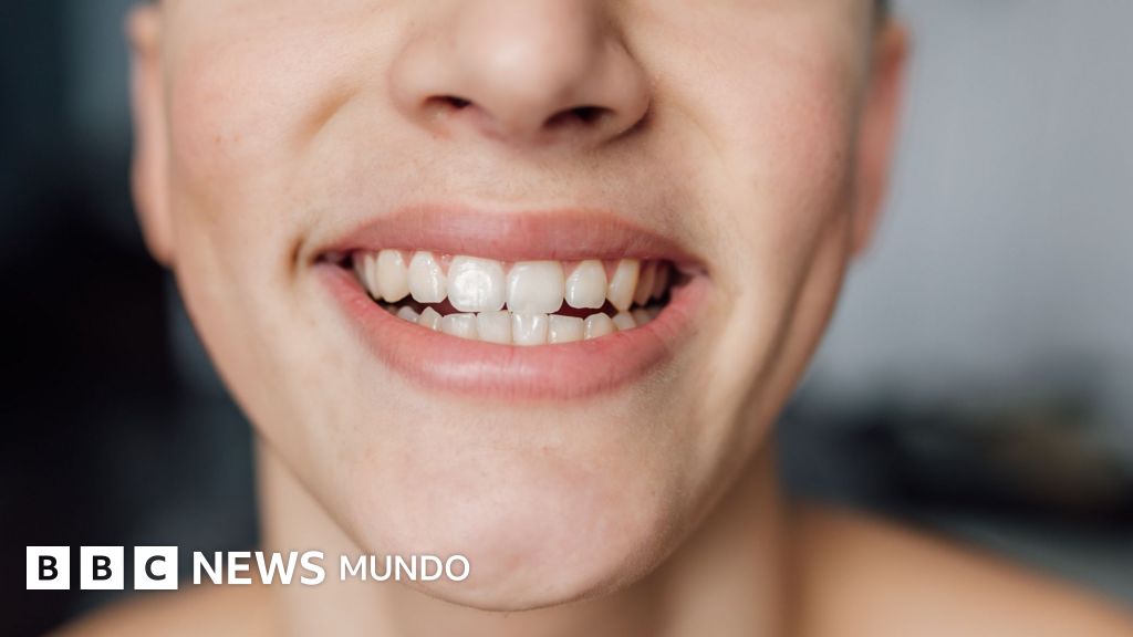 Qué debes comer para proteger las bacterias beneficiosas de tu boca