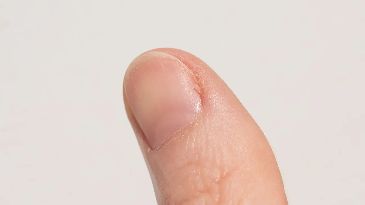 Un pequeño cambio en el color de tus uñas podría estar relacionado con tu salud