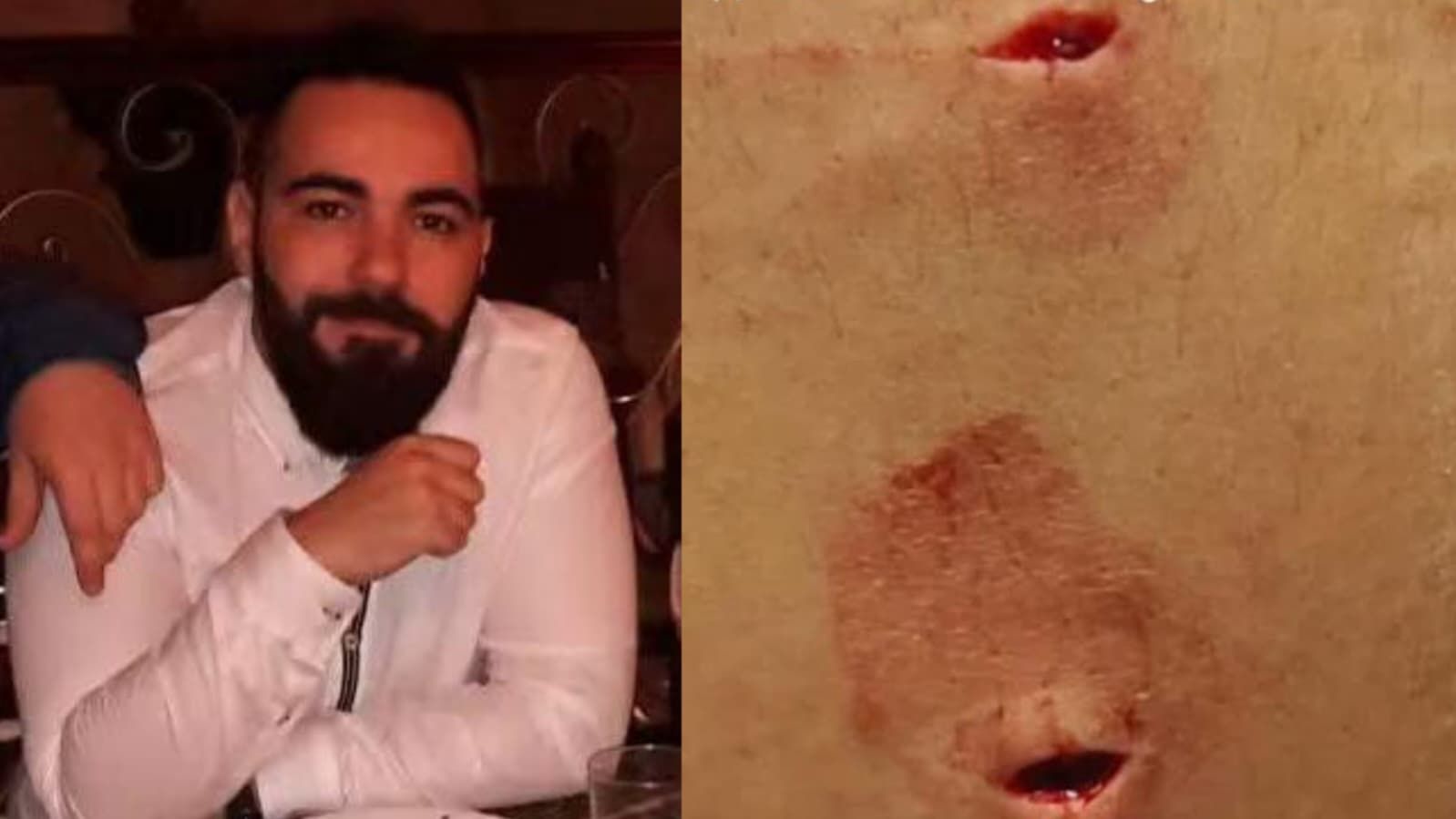 Gabriel Ramírez, el joven apuñalado por inmigrantes de madrugada en Ceuta: "Escapé porque sé artes marciales"