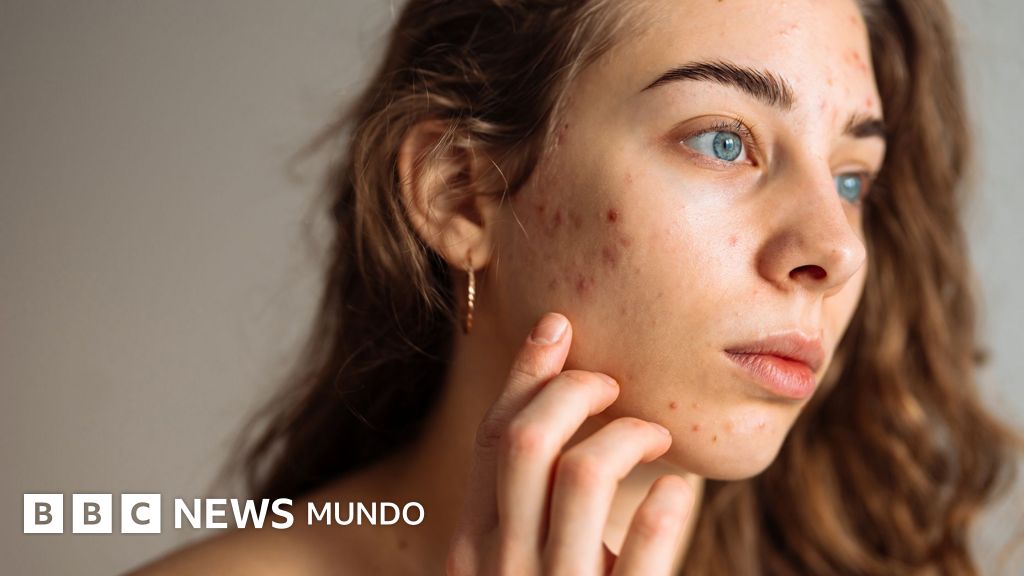 5 consejos de expertos para que los adolescentes cuiden su piel