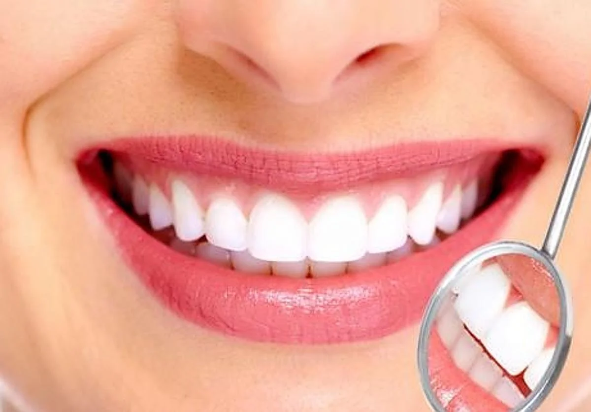 Retiran unos blanqueadores dentales por posibles riesgos para la salud