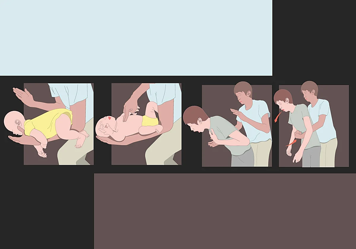 Caramelos, carne y salchichas: el 65% de los atragantamientos en niños son causados por alimentos