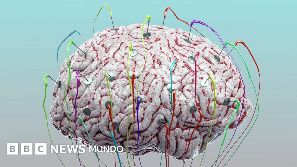 ¿Puede la estimulación tecnológica mejorar el funcionamiento de nuestro cerebro?