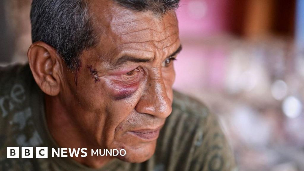 "Nunca pensé que me iban a atacar a mí": hablan los sobrevivientes del ataque con misil al Bloque 12, el edificio donde murió una mujer durante el bombardeo de EE.UU. en Venezuela