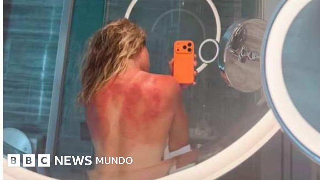"El sol de Australia no es broma": la foto de una tenista mexicana que muestra el riesgo en el país con las tasas de cáncer de piel más altas del mundo