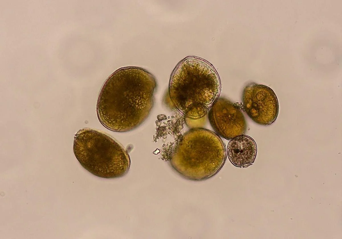 Detectan por primera vez en aguas del Mediterráneo una microalga que puede provocar intoxicaciones alimentarias