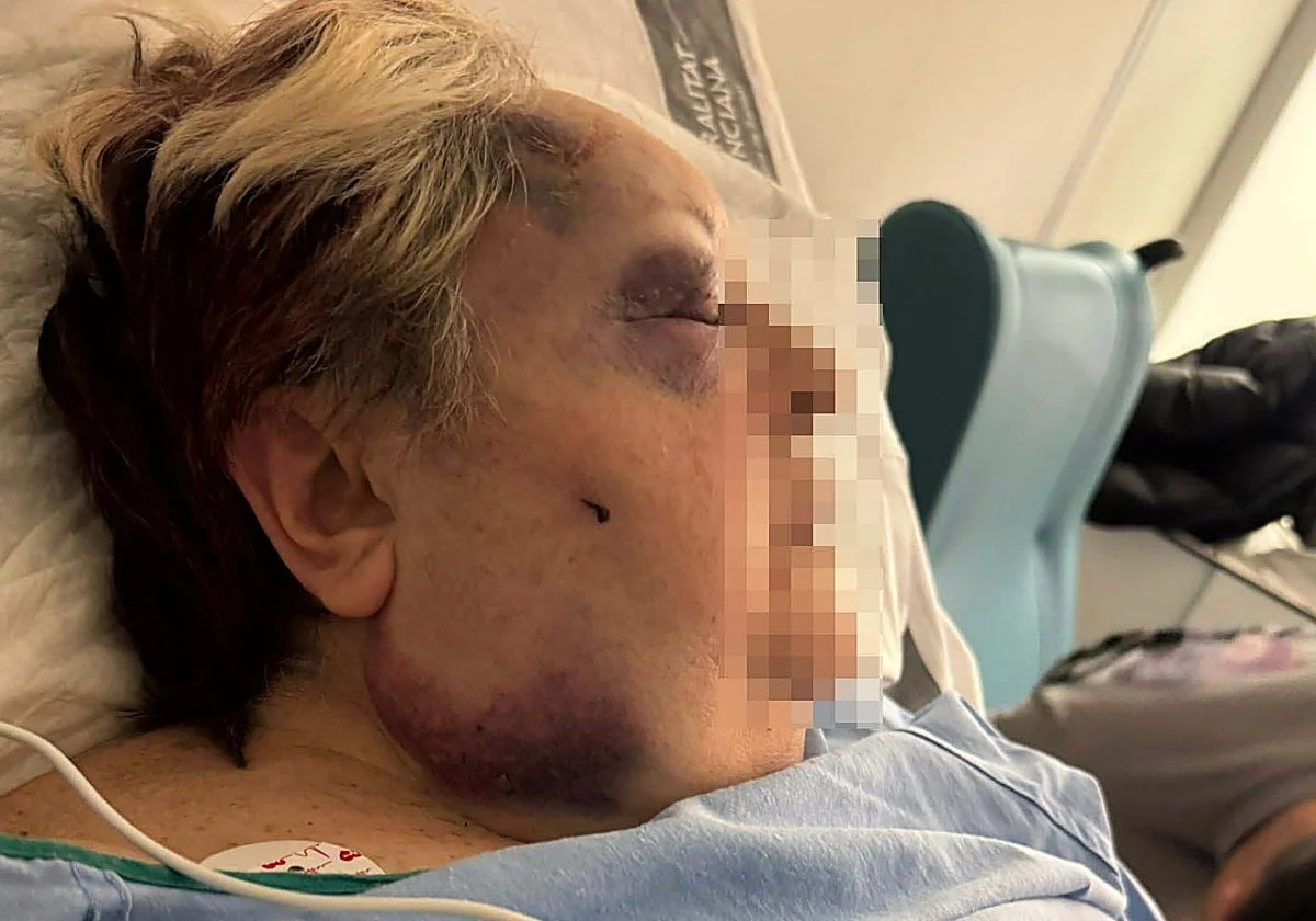 Agresión salvaje a una mujer de 71 años en Valencia por parte de dos jóvenes para robarle