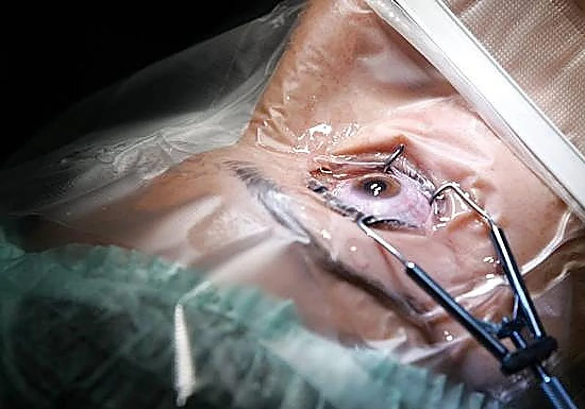 Rechazan la incapacidad permanente total a una conductora de autobús que padece halo nocturno y sensación de moscas volantes tras operarse la vista