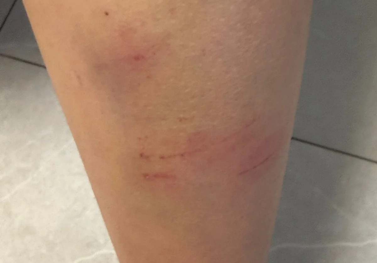 Denuncia una «paliza» de cuatro compañeros de instituto en Málaga y dice que sufre 'bullying' desde principio de curso