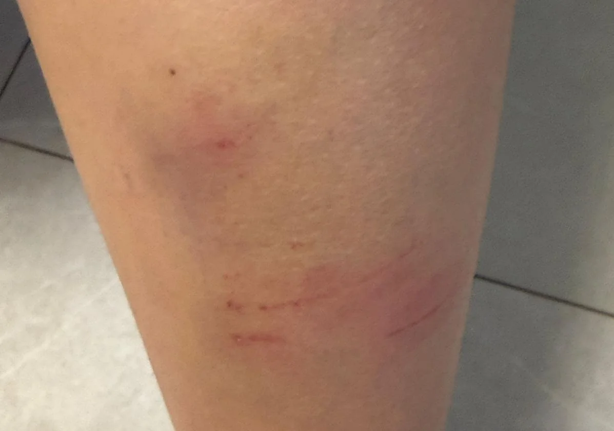 Malaga student reports continuous bullying after getting beaten up by classmates