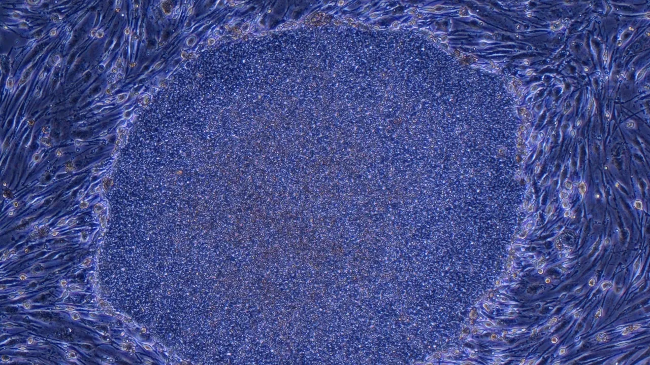 Japón aprueba los primeros tratamientos del mundo hechos con células humanas reprogramadas