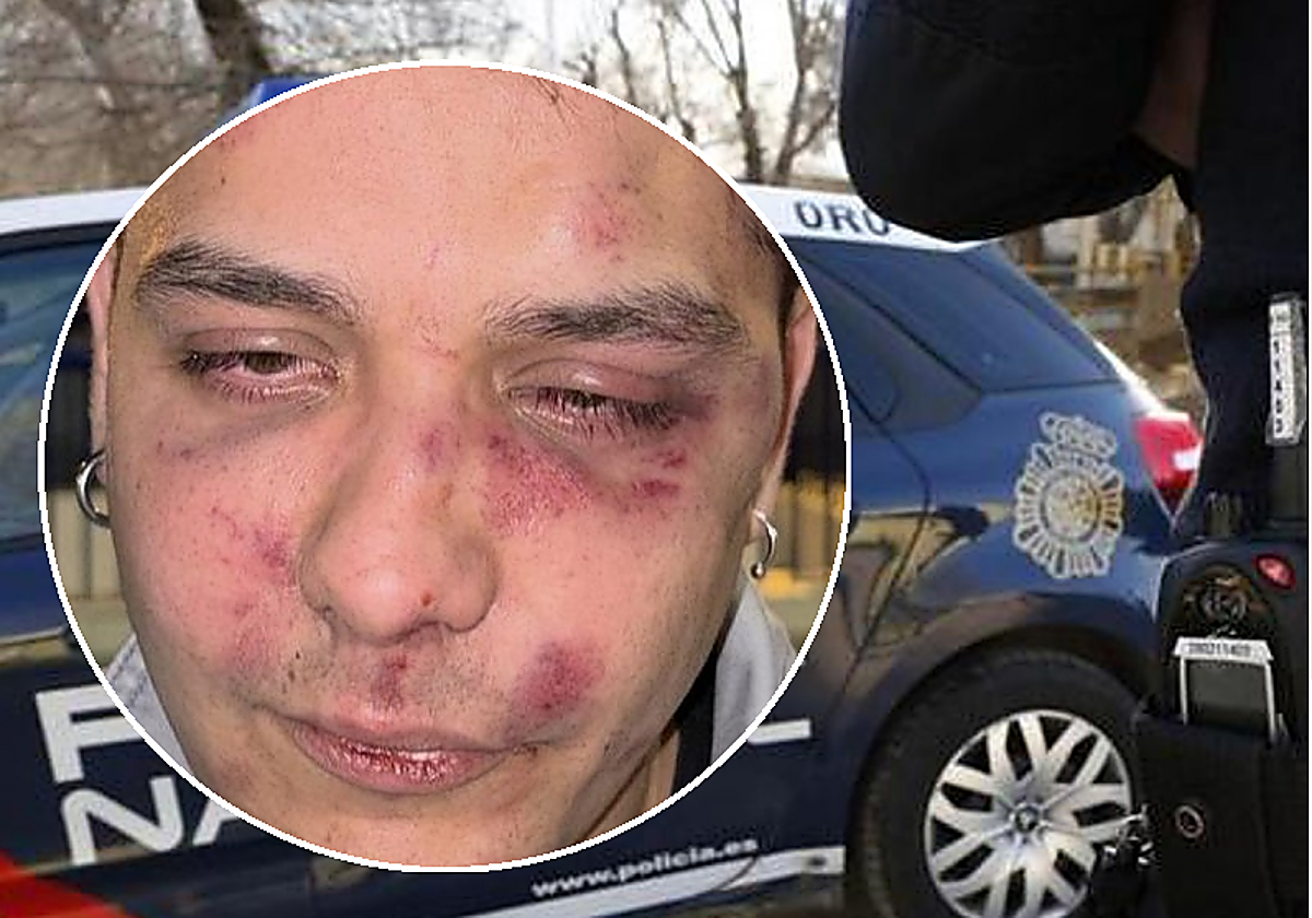 Dos detenidos por la paliza a un joven al grito de «antifascista» tras salir de una discoteca en Málaga