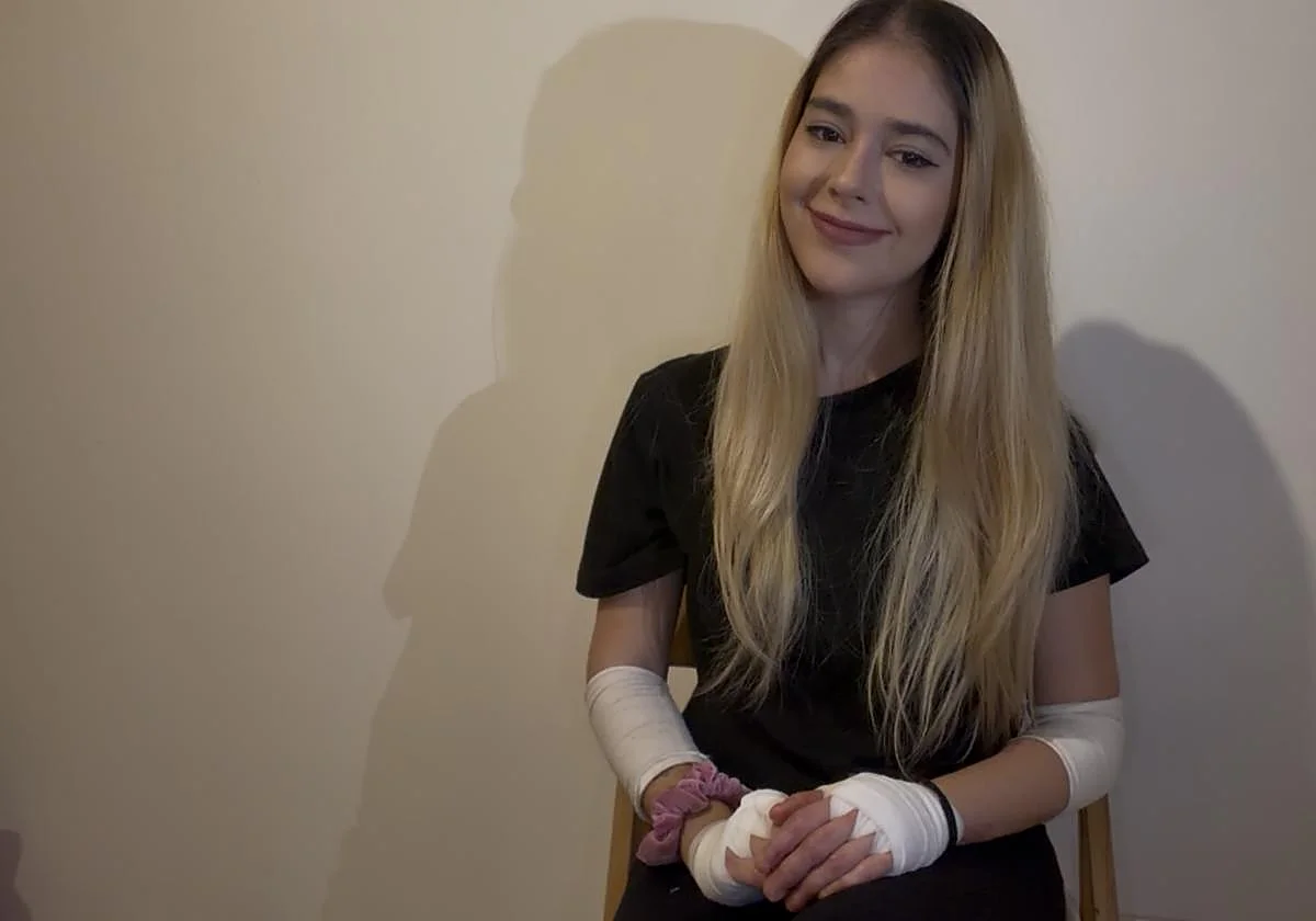 Mica, la influencer malagueña de la piel de mariposa con miles de seguidores