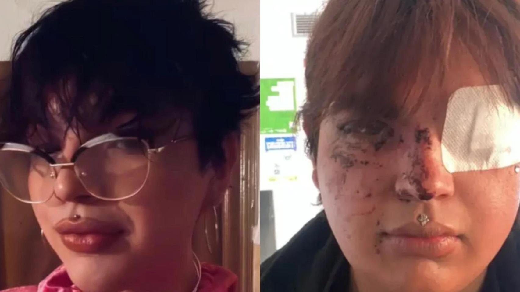 Bianca, la Miss Trans agredida por 10 en La Bañeza: creció siendo el "chico gordito" y vive en un pueblo de 550 vecinos