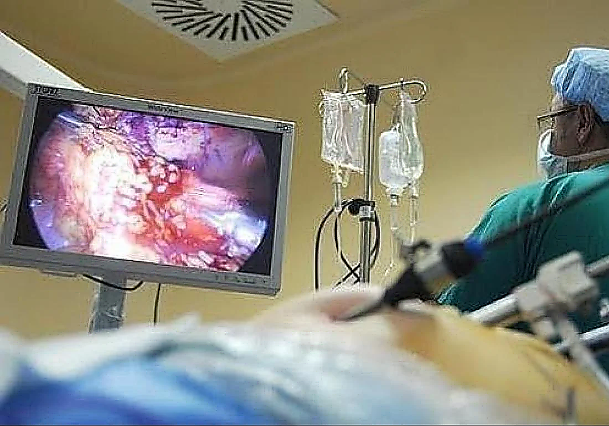 Seven out of ten Malaga residents do not respond to invitation for colon cancer screening