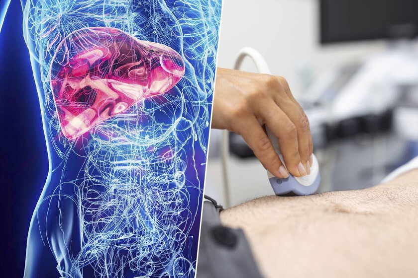 El hígado sufre en silencio: la epidemia del hígado graso que escapa a los análisis rutinarios y que la ciencia busca frenar