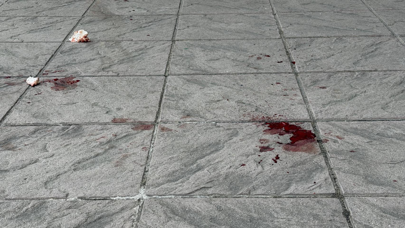 Pelea en el Orzán, en A Coruña: una persona acaba semiinconsciente y sangrando tras ser agredida