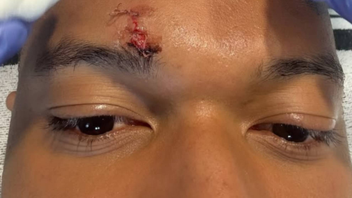 "Ya ni se molestan en disimular"