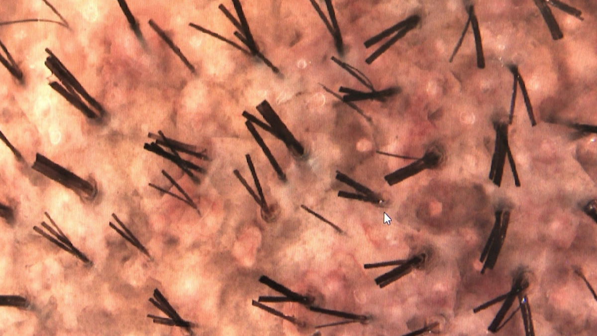 Un nuevo estudio cuestiona la teoría clásica sobre el crecimiento del pelo