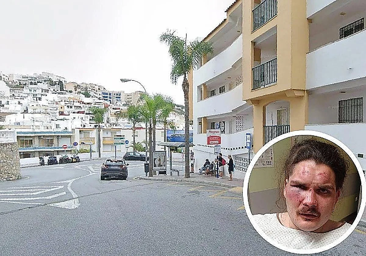 Two arrested following brutal attack of young man in La Herradura