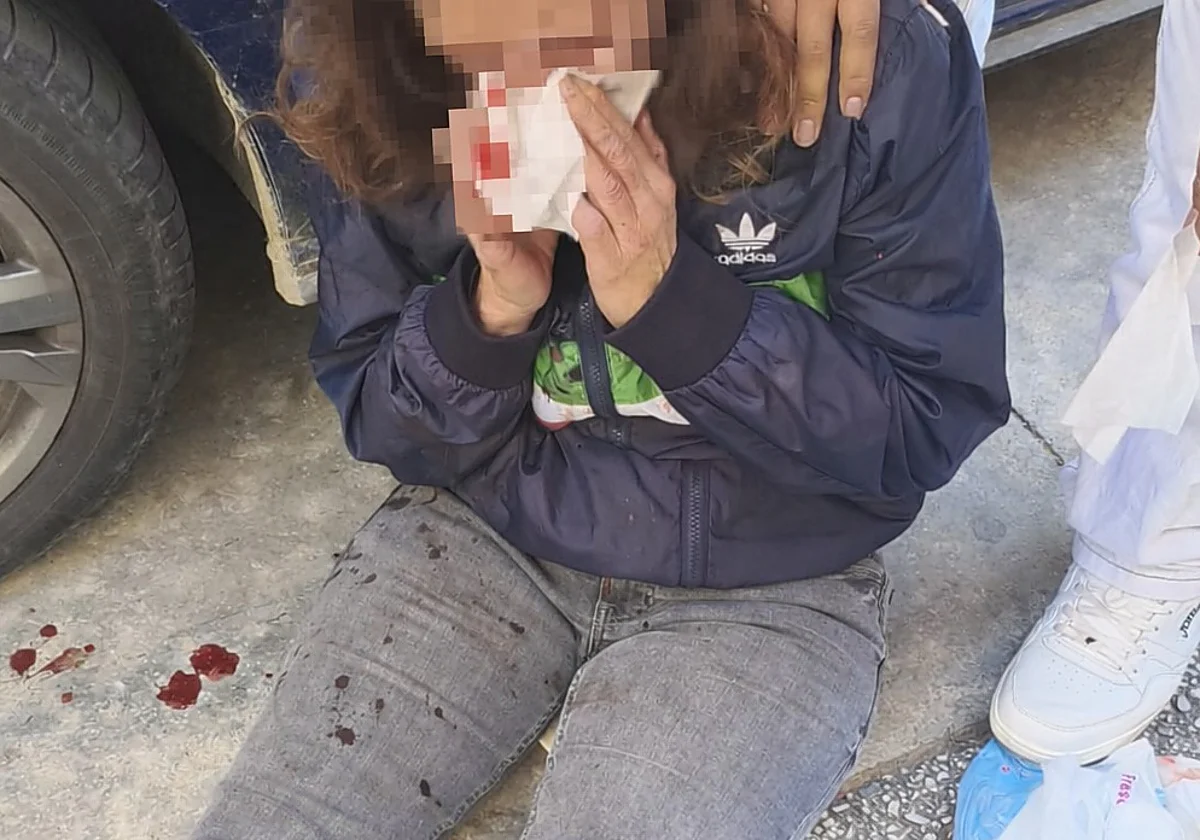 Detenido tras propinar un codazo a su pareja y tirarla al asfalto cuando circulaban en moto por Vélez-Málaga