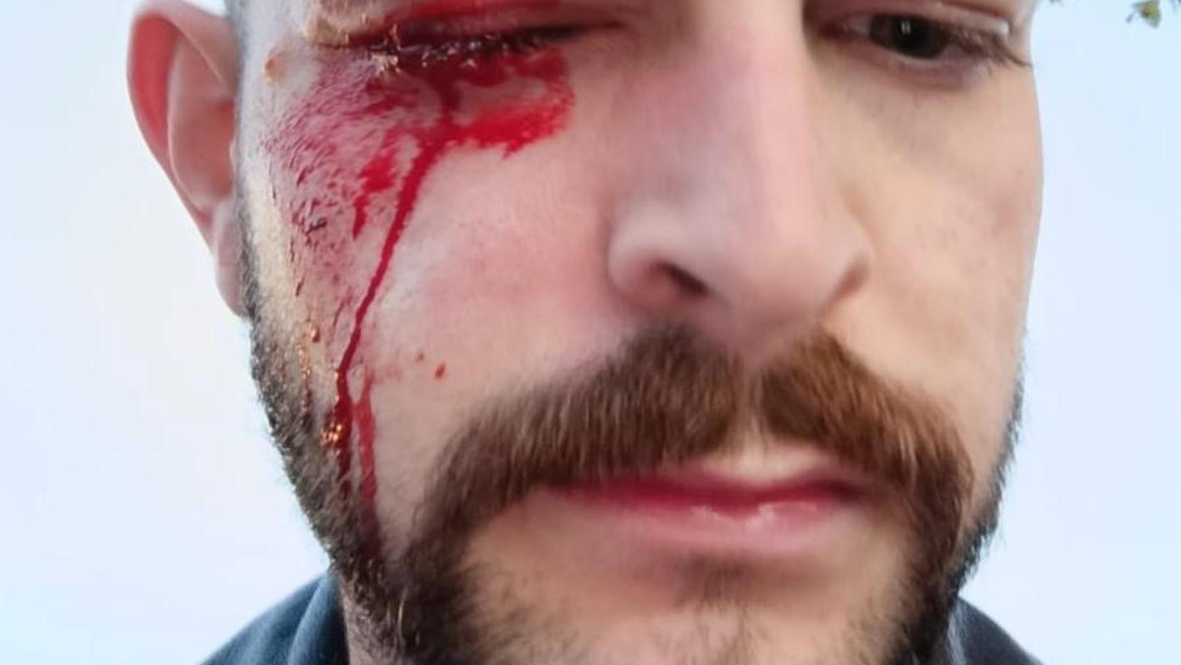 El PP pide al Congreso una condena de los actos de 'kale borroka' en los que se agredió a un periodista de El Español