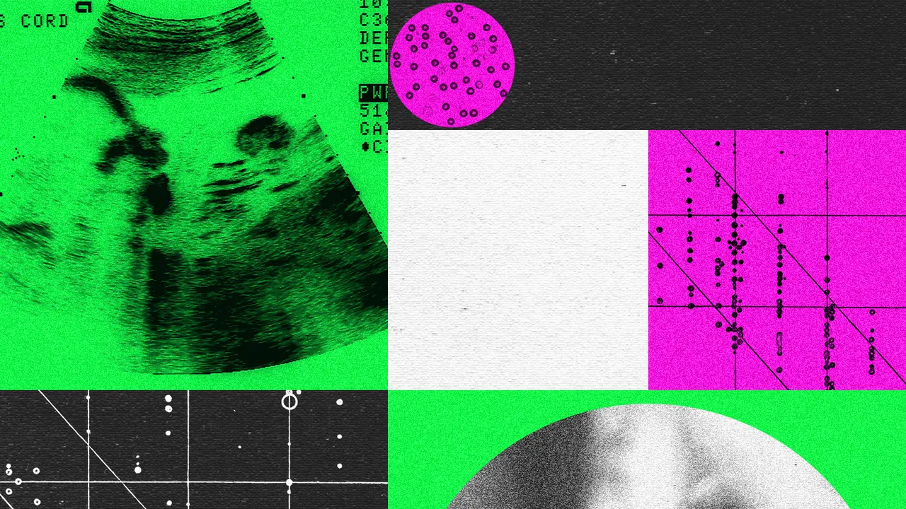 Las empresas de bebés diseñados genéticamente están en crisis