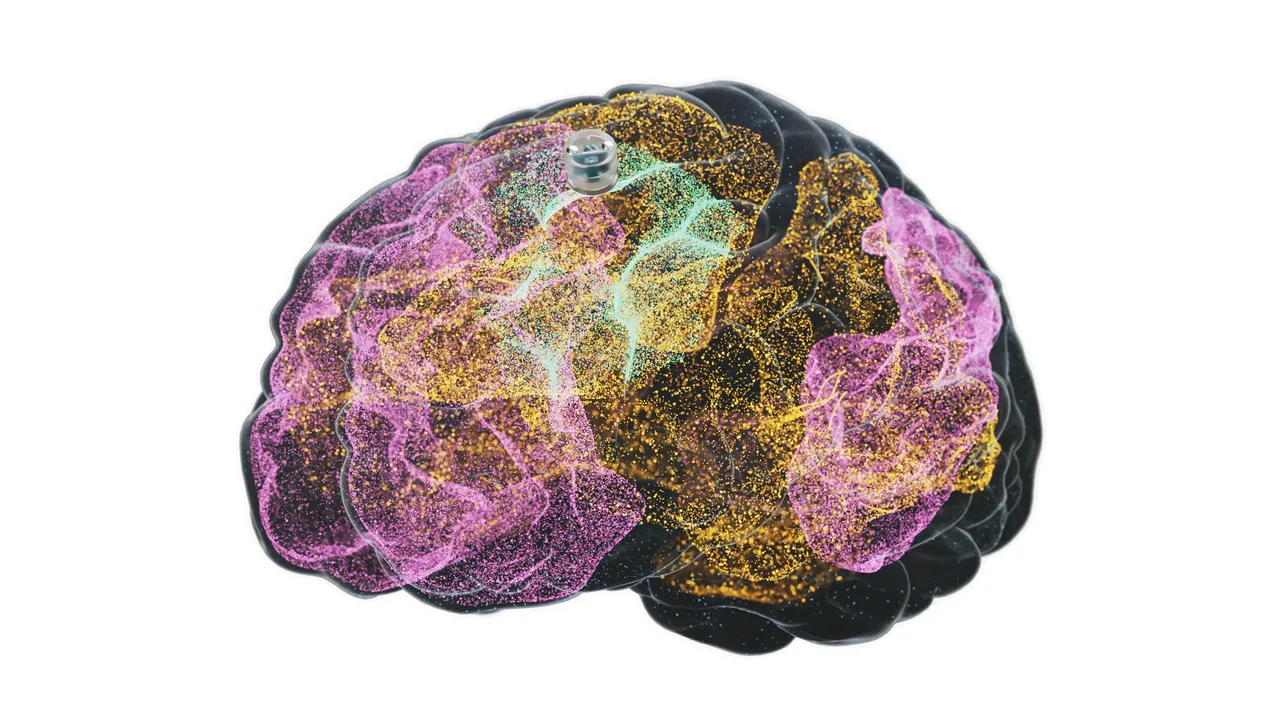 El primer implante cerebral contra la depresión por fin se probará en humanos