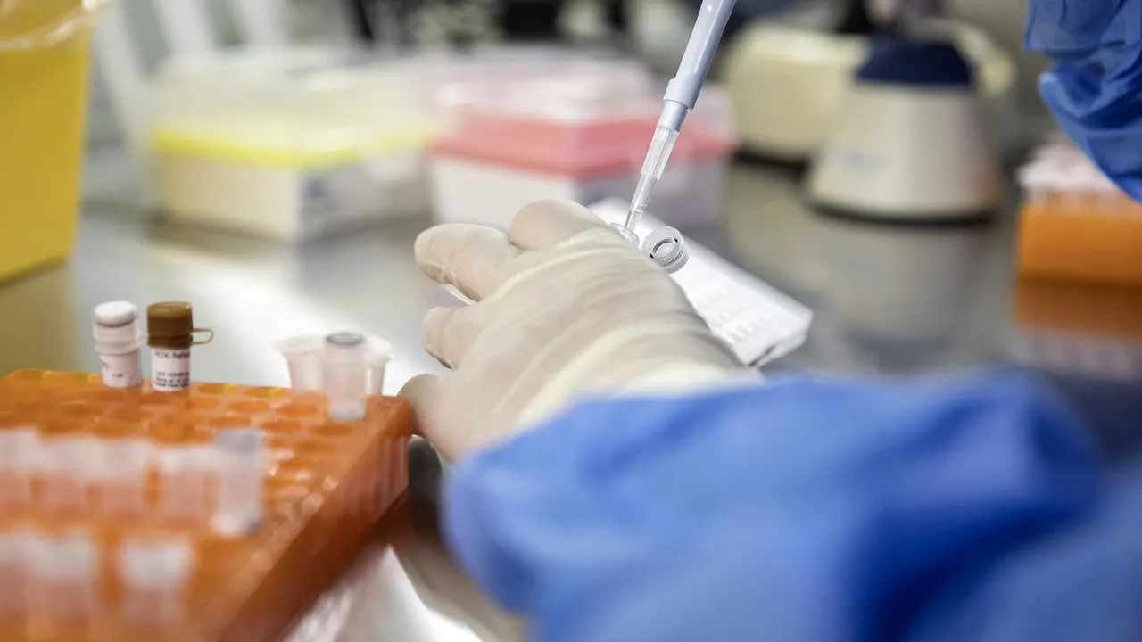 Reprogramar el sistema inmunitario es la nueva apuesta para controlar el VIH