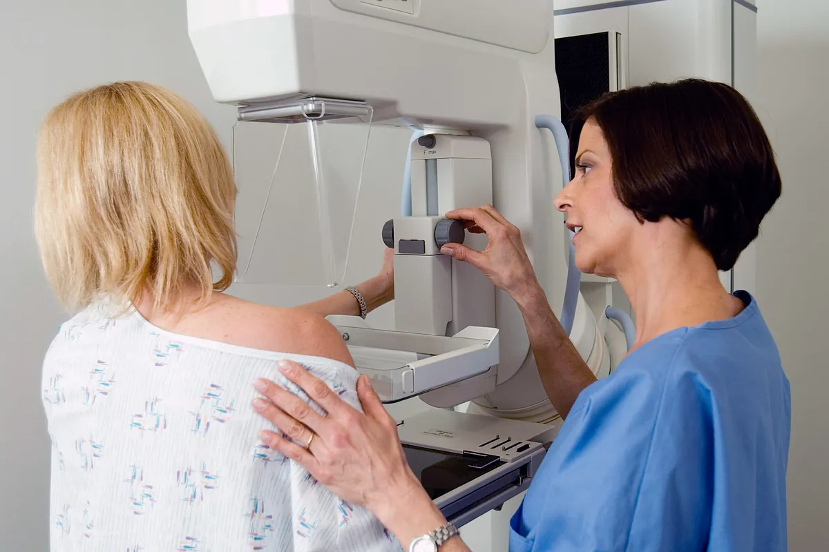 Sanidad amplía el cribado de cáncer de mama a mujeres de entre 45 y 74 años