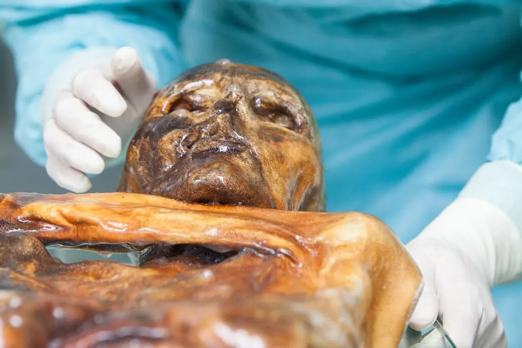 La momia de Özti, el hombre de hielo, es una despensa de microbios milenarios