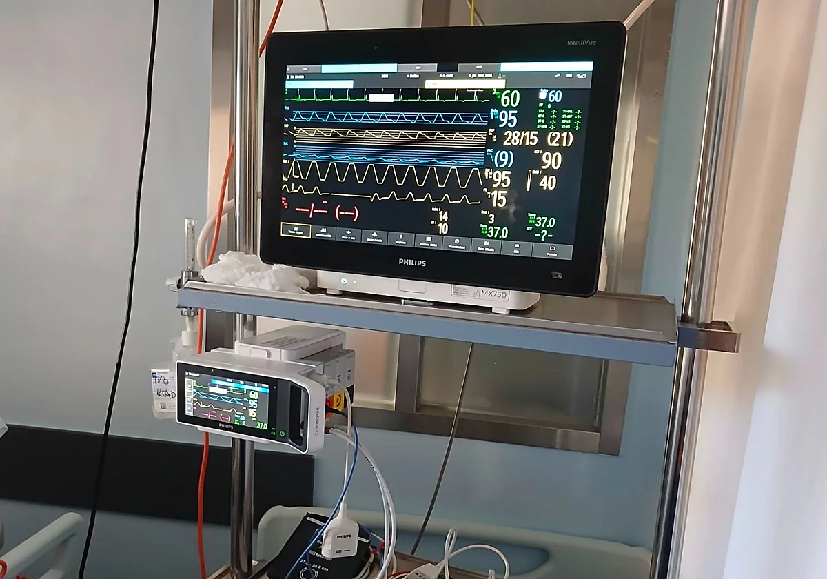 La UCI del Hospital de Antequera estrena monitorización avanzada