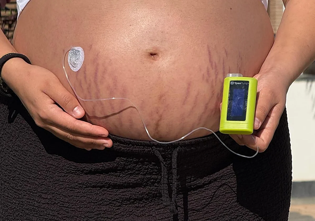 La diabetes gestacional afecta al 10% de las embarazadas y puede marcar la salud del bebé