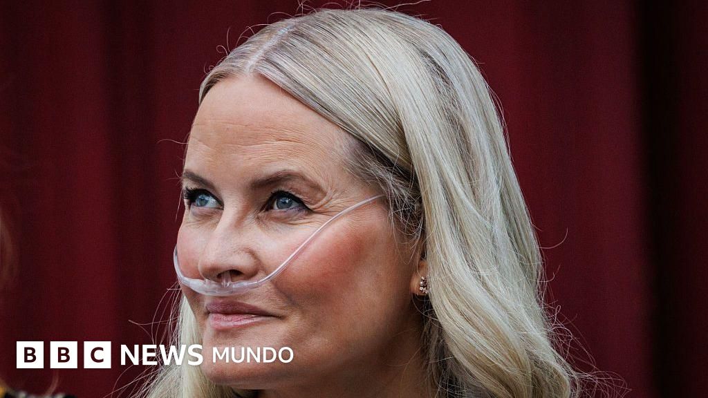 La princesa heredera de Noruega Mette-Marit se somete a un trasplante de pulmón